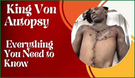 Unseen Autopsy Images Of King Von: The Tragic Aftermath Revealed